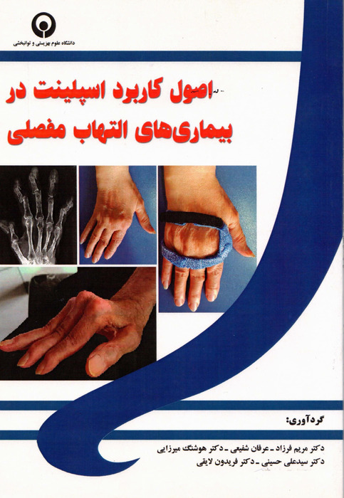 اصول کاربرد اسپیلنت در بیماریهای التهاب مفصلی
