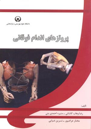 پروتزهای اندام فوقانی