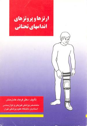 ارتز و پروتز اندامهای تحتانی